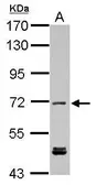 Anti-KBTBD3 antibody used in Western Blot (WB). GTX123289