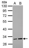 Anti-LRRC19 antibody used in Western Blot (WB). GTX123305