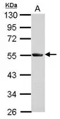Anti-SLA/LP antibody used in Western Blot (WB). GTX123307