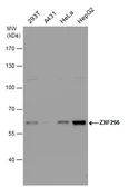 Anti-ZNF266 antibody used in Western Blot (WB). GTX123310