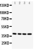 Anti-Caspase 12 antibody used in Western Blot (WB). GTX12333