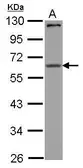 Anti-CPEB1 antibody used in Western Blot (WB). GTX123357