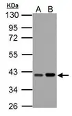 Anti-PECI antibody used in Western Blot (WB). GTX123400