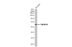 Anti-TMEM108 antibody used in Western Blot (WB). GTX123412