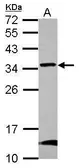 Anti-GBAS antibody used in Western Blot (WB). GTX123417