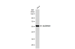 Anti-ALDH1A1 antibody used in Western Blot (WB). GTX123426