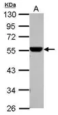 Anti-ALDH1A1 antibody used in Western Blot (WB). GTX123427