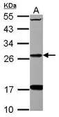 Anti-DHRS2 antibody used in Western Blot (WB). GTX123431