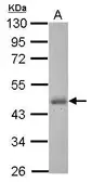 Anti-Casein Kinase 1 delta antibody used in Western Blot (WB). GTX123435