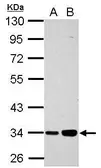 Anti-PARP16 antibody used in Western Blot (WB). GTX123450