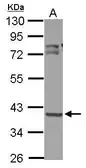 Anti-OXSM antibody used in Western Blot (WB). GTX123463