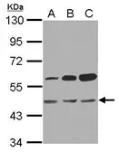 Anti-OXSM antibody used in Western Blot (WB). GTX123464
