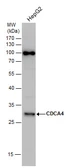 Anti-CDCA4 antibody used in Western Blot (WB). GTX123498