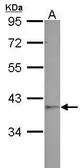 Anti-GALM antibody used in Western Blot (WB). GTX123515