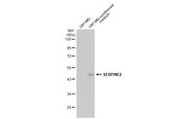Anti-SERPINE2 antibody used in Western Blot (WB). GTX123522