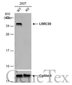 Anti-LRRC59 antibody used in Western Blot (WB). GTX123532