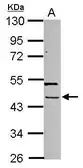 Anti-PHAX antibody used in Western Blot (WB). GTX123554