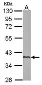 Anti-TSARG2 antibody used in Western Blot (WB). GTX123559