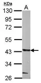 Anti-GLT8D1 antibody used in Western Blot (WB). GTX123636