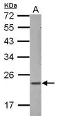 Anti-ZNF22 antibody used in Western Blot (WB). GTX123643