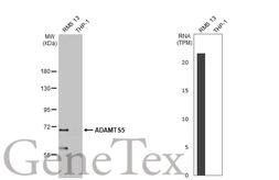 Anti-ADAMTS5 antibody [N3C2], Internal used in Western Blot (WB). GTX123657