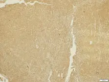 Anti-ADAMTS5 antibody [N3C2], Internal used in IHC (Paraffin sections) (IHC-P). GTX123657