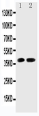 Anti-CDK6 antibody used in Western Blot (WB). GTX12366