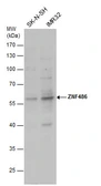 Anti-ZNF486 antibody used in Western Blot (WB). GTX123668