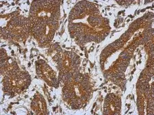 Anti-Caspase 1 p10 subunit antibody used in IHC (Paraffin sections) (IHC-P). GTX123675