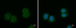 Anti-SPINK1 antibody used in Immunocytochemistry/ Immunofluorescence (ICC/IF). GTX123685