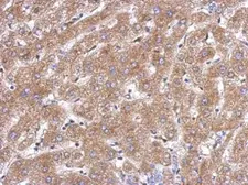 Anti-ACOT12 antibody used in IHC (Paraffin sections) (IHC-P). GTX123722