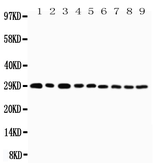Anti-CD134 antibody used in Western Blot (WB). GTX12380