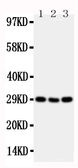 Anti-CD134 antibody used in Western Blot (WB). GTX12386