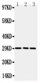 Anti-CD134 antibody used in Western Blot (WB). GTX12387