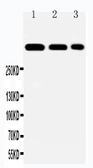 Anti-Laminin alpha 2 antibody used in Western Blot (WB). GTX12391