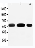 Anti-EAAT3 antibody used in Western Blot (WB). GTX12393