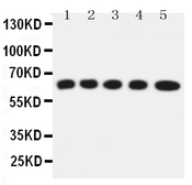 Anti-SLC22A5 antibody used in Western Blot (WB). GTX12395