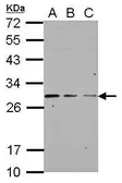 Anti-GBAS antibody used in Western Blot (WB). GTX123963