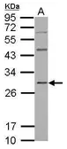 Anti-GBAS antibody used in Western Blot (WB). GTX123964