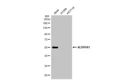 Anti-ALDH1A1 antibody used in Western Blot (WB). GTX123973