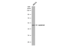 Anti-ALDH1A1 antibody used in Western Blot (WB). GTX123974