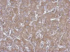 Anti-ALDH1A1 antibody used in IHC (Paraffin sections) (IHC-P). GTX123974