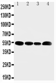 Anti-SLC16A4 antibody used in Western Blot (WB). GTX12399