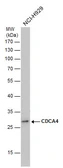 Anti-CDCA4 antibody used in Western Blot (WB). GTX124045