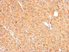 Anti-GALM antibody used in IHC (Paraffin sections) (IHC-P). GTX124062