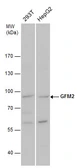 Anti-GFM2 antibody used in Western Blot (WB). GTX124071