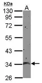 Anti-CCDC90A antibody used in Western Blot (WB). GTX124078