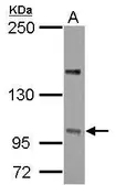 Anti-PP4R4 antibody [C2C3], C-term used in Western Blot (WB). GTX124107