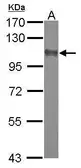 Anti-Dlgap2 antibody [N1], N-term used in Western Blot (WB). GTX124115