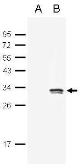 Anti-GFP antibody used in Western Blot (WB). GTX124117